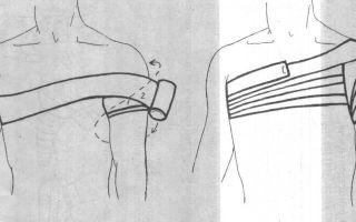 Использование колосовидной повязки при травмах плеча