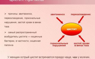 Переохлаждение как причина цистита