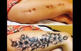 Маскировка шрамов татуировкой