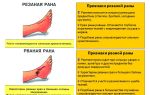 Признаки и лечение резаных ран