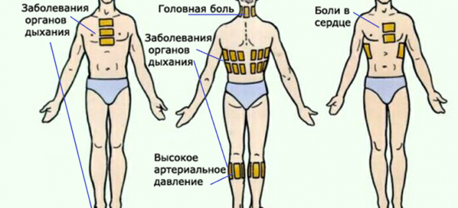 Как правильно применять горчичники при простуде