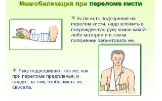 Первая помощь при переломе кисти руки, лечение и восстановительный период