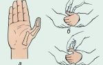 Симптомы и лечение вывиха большого пальца на руке