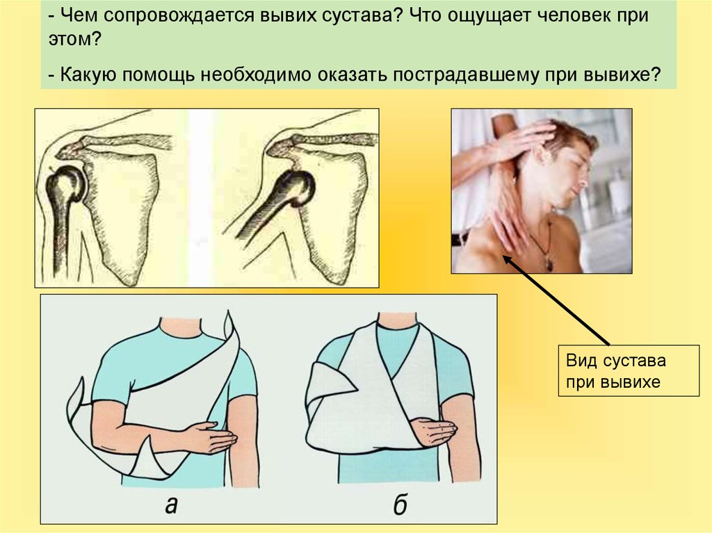 Картинка вывих первая помощь